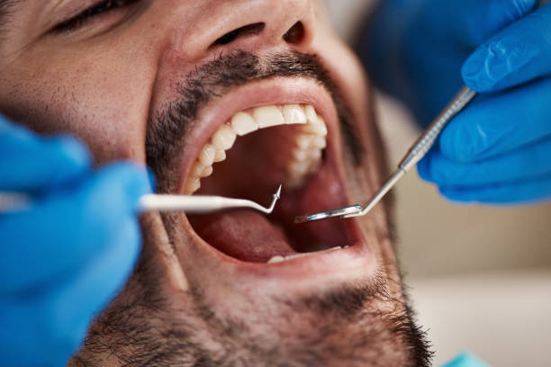 Best Emergency Treatment for Dental Infections or Abscesses in Cottonwood, MN