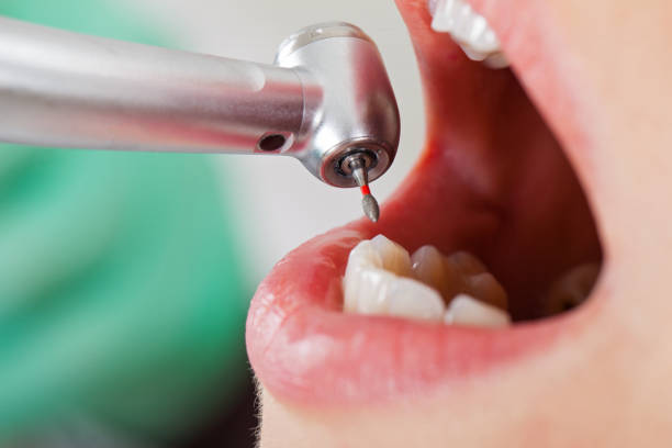 Best Pediatric Emergency Dentist in Cottonwood, MN